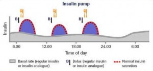 insulin pump basal rate
